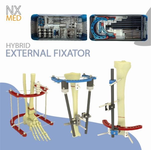 Hybrid External Fixator