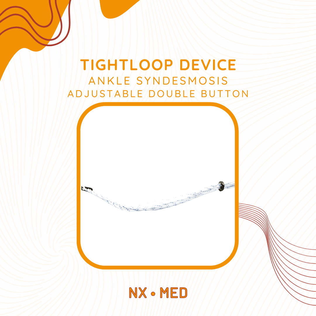 Tightloop Device Double Button Implant for Ankle Syndesmosis